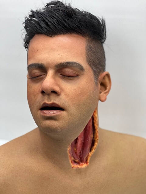 A special effects head of a young man bearing neck wound.